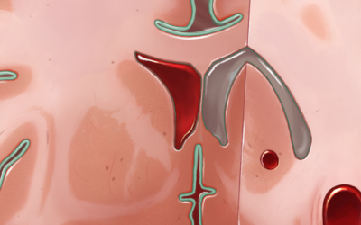 Intracranial Hemorrhage Compartments