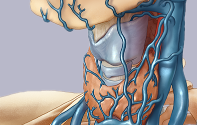 Venous Bridge Syndromes