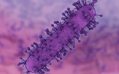 Pathology of Diptheria