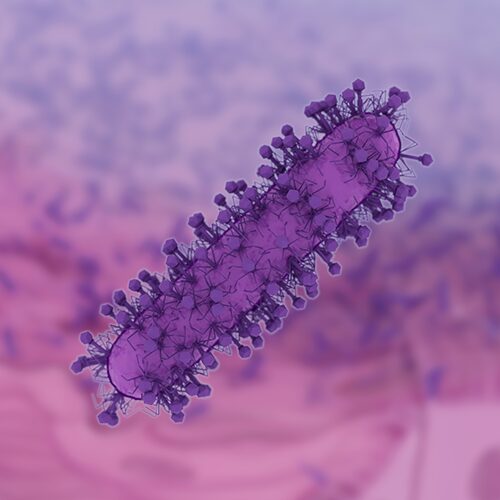 Pathology of Diptheria